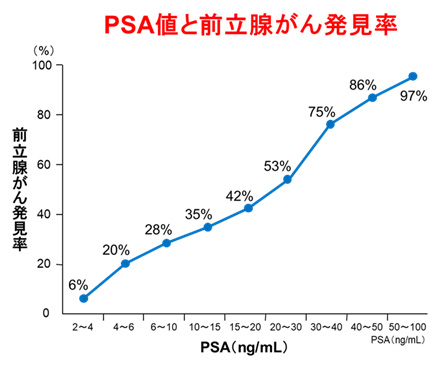PSA検査とは何ですか?